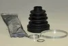 Автозапчасть GKN (Lobro) 306615 (фото 1)