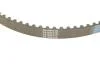 Комплект ГРМ Land Rover Discovery/Range Rover 2.7D 04- (82zx20) HEPU 20-2079 (фото 3)