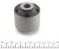 Втулка важеля PARTS KAVO SCR-5531 (фото 3)