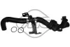 Патрубок радиатора Citroen C4, C5, Berlingo / Peugeot 206, 407 1.6HDI (03792) Metalcaucho