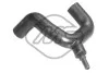 Патрубок радиатора Renault Megane 1.4, 1.6 (99-) (08750) Metalcaucho