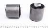 Сайлентблоки важеля BMW 1 (E81-E88) 3 (E90-E93), 5 (E60) 03- перед. міст MEYLE 314 610 0000/HD (фото 4)