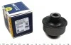 Сайлентблок важеля OPEK ASTRA F, VECTRA A 88-05 перед. міст низ (Вир-во MEYLE) 614 035 0002/HD
