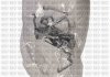 Гальмiвнi колодки дисковi QUINTON HAZELL BP1966 (фото 2)