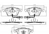 Колодки гальмівні (передні) Audi A4 03-09/A6/A8 03-11/Seat Exeo 08-13 (+датчики) SKF VKBP80617E (фото 6)