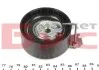 Механізм натяжний CITROEN : Berlingo, C-Elysée, C2, C3, C4, C5, Xsara, Xsara Picasso - PEUGEOT: 1007, 206, 207, 301, 307, 307 SW, 308, Partner, Ranch SNR NTN GT359.28 (фото 3)