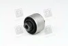 Сайлентблок AUDI/SEAT/SKODA/VW A4/A6/A8/Exeo/Superb/Passat &quot;F &quot;94-&quot;05 TRW JBU642 (фото 3)
